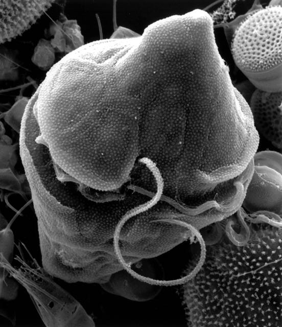 Electron micrograph of a dinoflagellate, {em}Heterocapsa triquetra{/em}, found in a water sample of a York River spring bloom. The two flagella are clearly visible.© E. Westcott/VIMS.